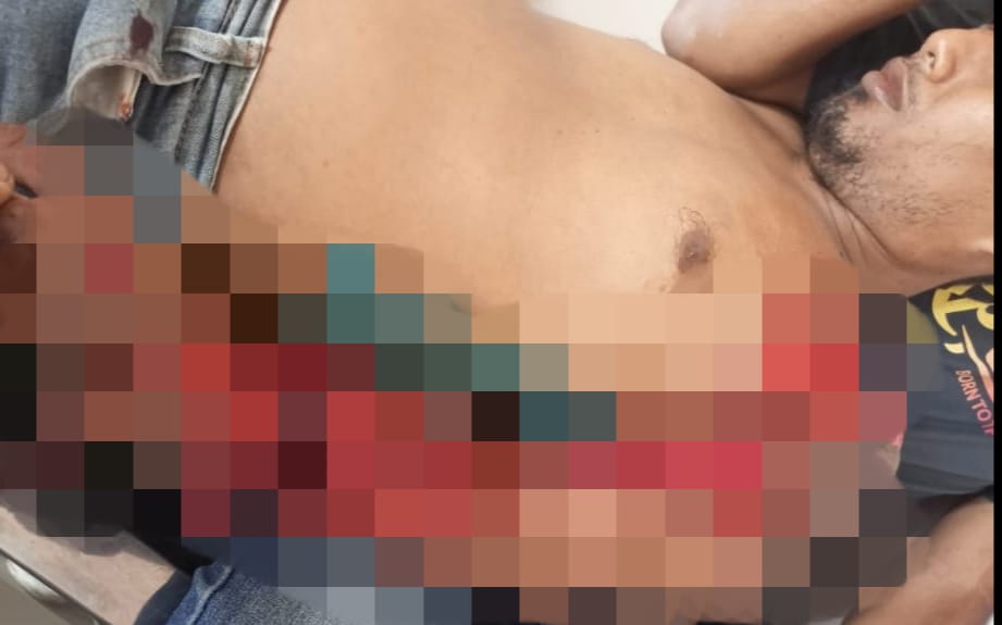 Alami Kecelakaan Kerja, Tangan Kiri Buruh ini Luka Parah
